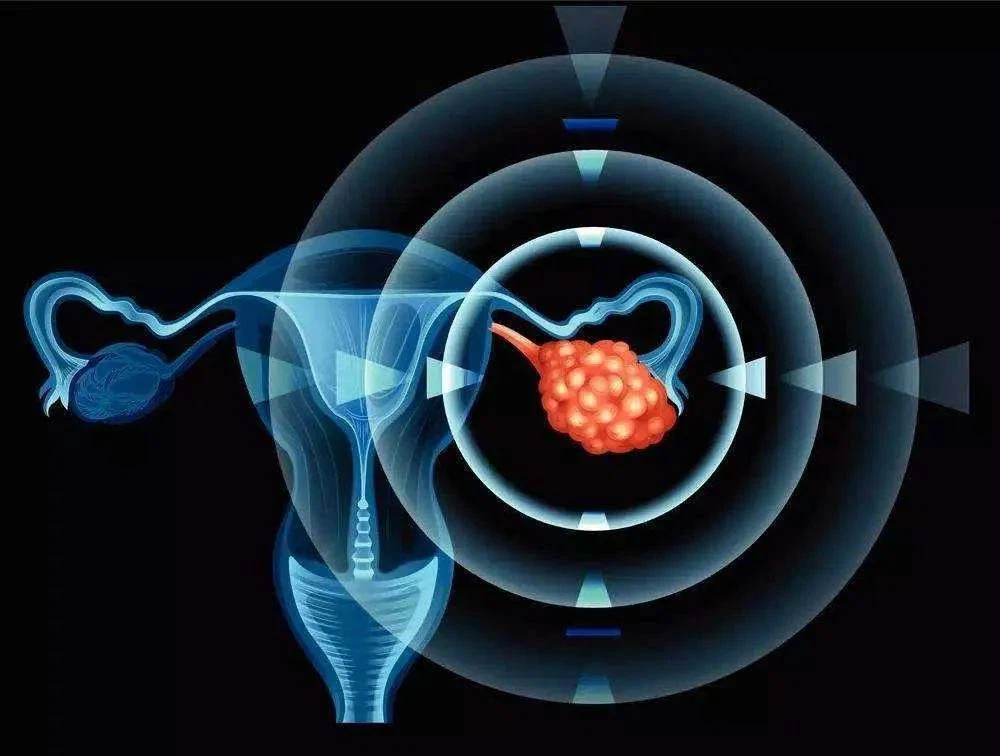 NMN treatment of polycystic ovary syndrome, fasting insulin level completely returned to normal state.