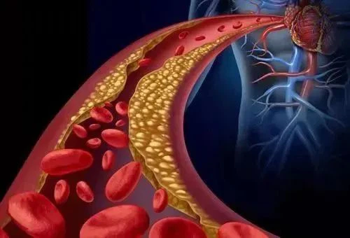 NMN Improves Mild Hypertension