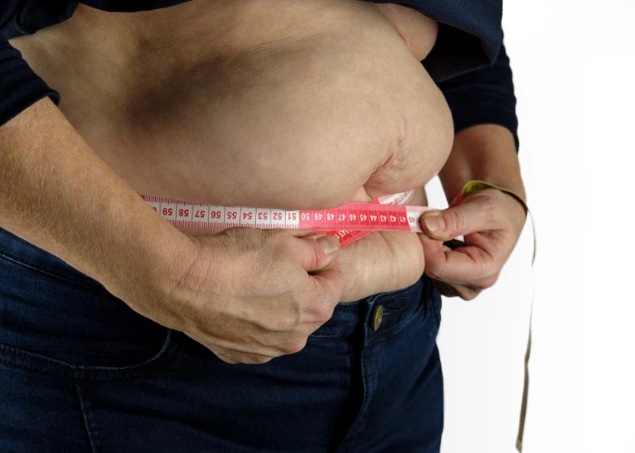 NMN Administration Reverses Obesity