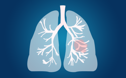 2022 NMN Research Year-end Inventory: Reduce New Coronavirus Infection, Protect Cardiovascular Health, And Reduce Acute Lung Injury