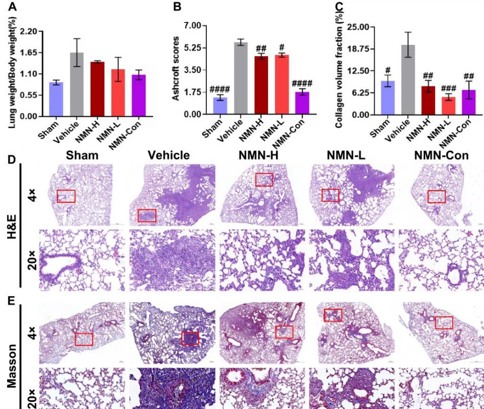 NMN Effectively Improves Lung Injury And Lung Tissue Aging