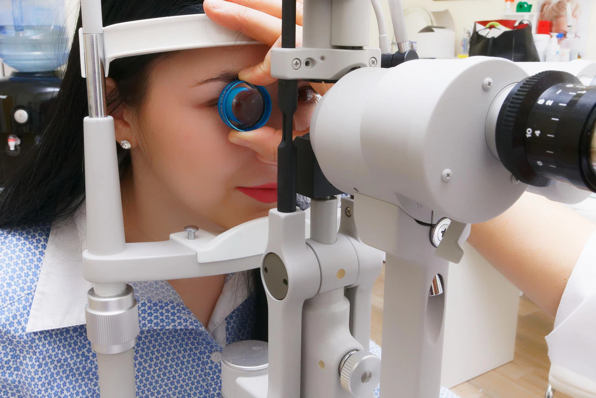 The therapeutic effect of NMN on vision degenerative diseases