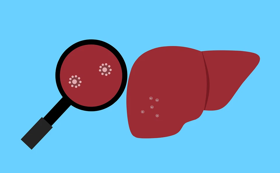 Hepatoprotective effect of reduced glutathione