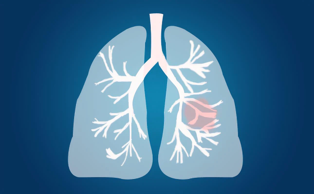 NMN prevents lung cells from entering senescence